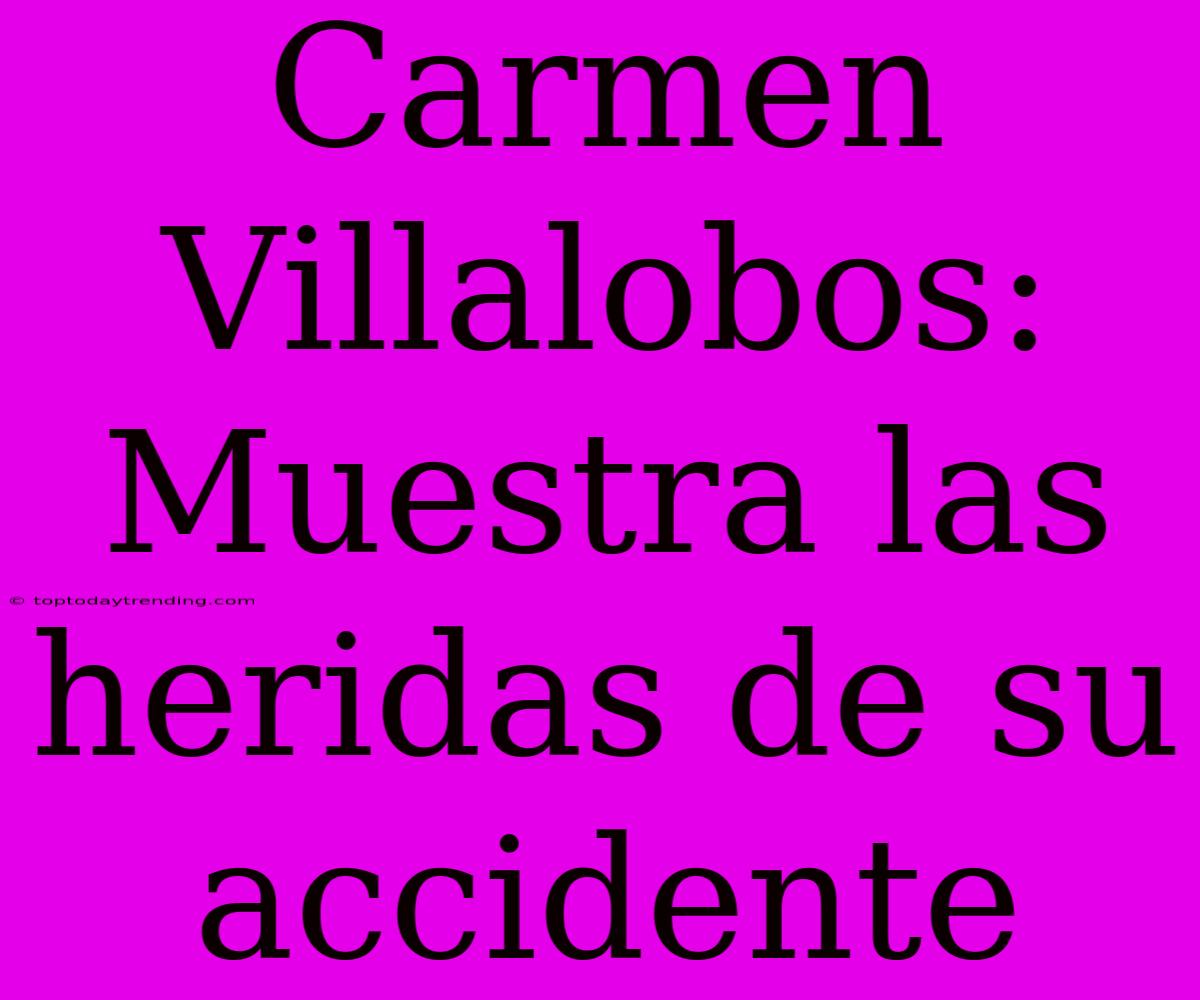 Carmen Villalobos: Muestra Las Heridas De Su Accidente